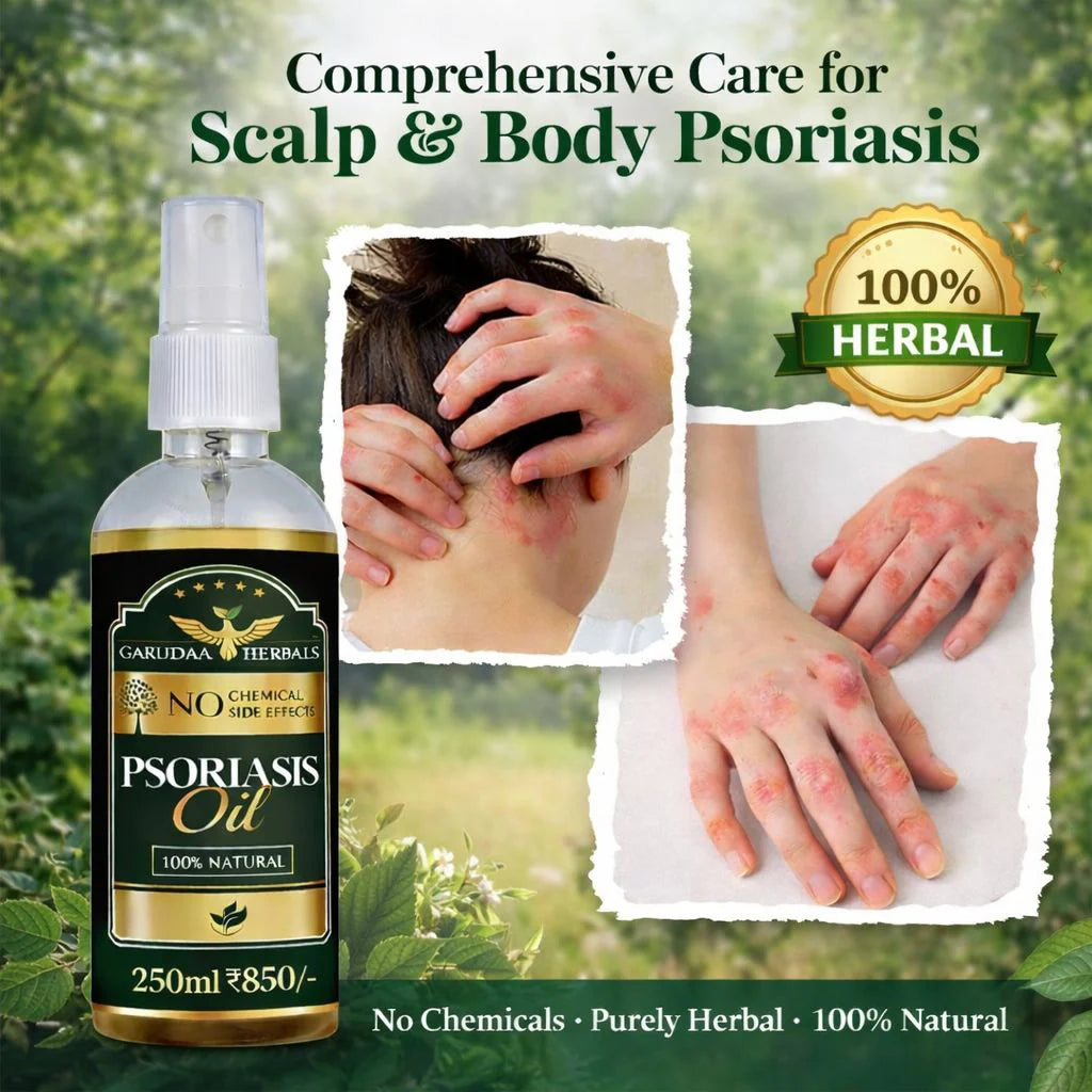 Garuda Herbal Psoriasis Oil-Advanced Psoriasis Clearing Oil